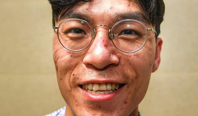 這些刻在我們臉上的印痕，會成為永恒的記憶！